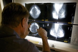 como funciona a mamografia