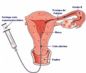 inseminacao intra uterina