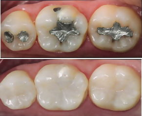 clareador dental whitemax como usar
