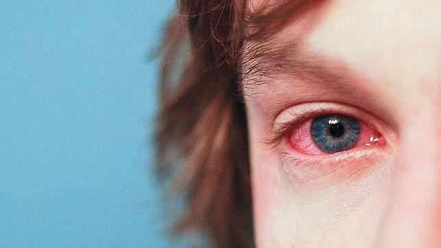 alergia nos olhos