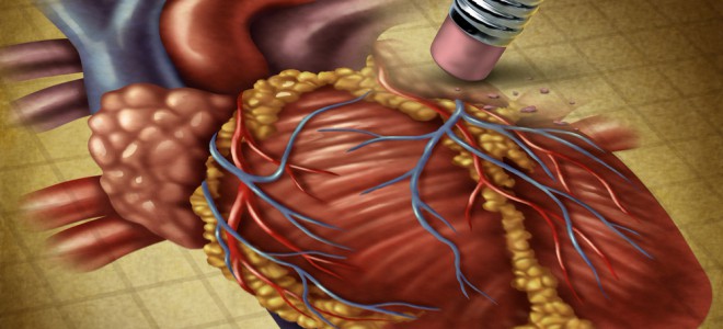 isquemia cardíaca