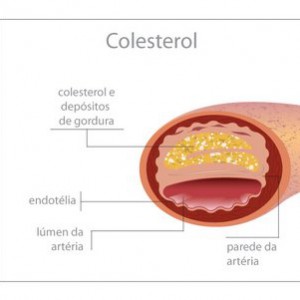 colesterol VLDL