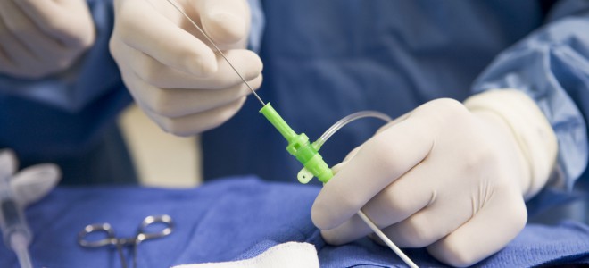 Cateter também é utilizado para permitir o acesso de instrumentos cirúrgicos. Foto: Shutterstock