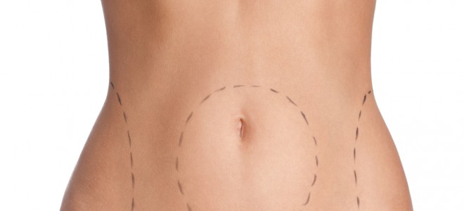 Abdominoplastia promete recuperar a firmeza dos músculos da região abdominal. Foto: Shutterstock