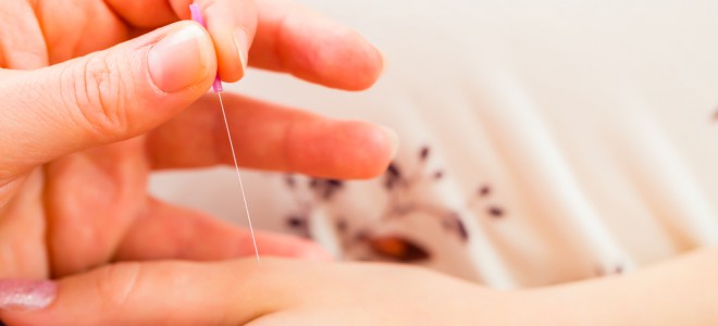acupuntura para engravidar
