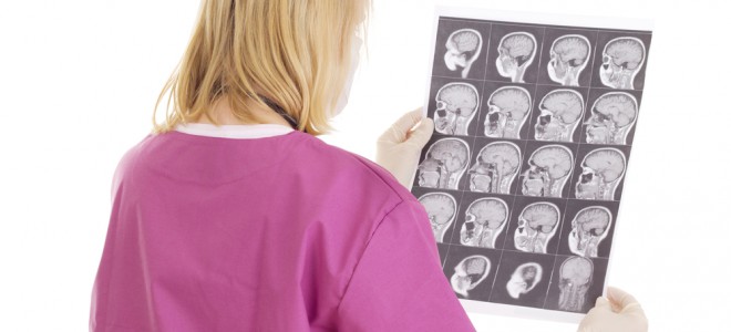 O diagnóstico da esclerose múltipla deve ser realizado por um neurologista. Foto: Shutterstock
