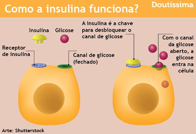 bomba de insulina infográfico